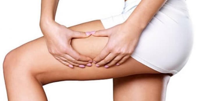 Anti-cellulite Diet – How to Prevent Our Body from Cellulite