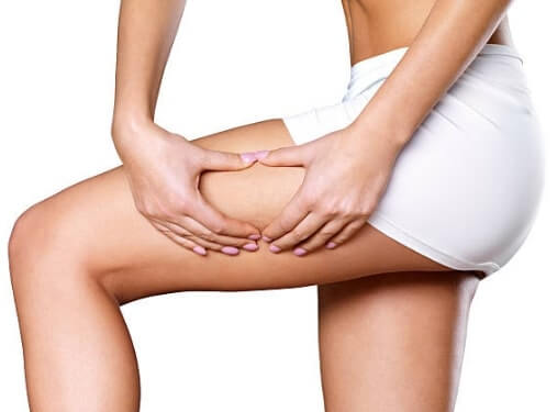 How to get rid of cellulite