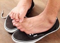 Fungal Infection On the Feet – Symptoms & Treatment