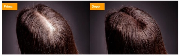 vitahair max, before after
