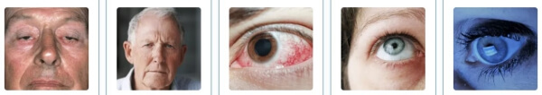 eye problems, causes, eye vision
