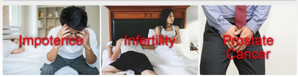 impotence, infertility, prostate cancer