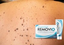 Removio – All-Natural and Painless Papilloma Removal Formula With Proven Results
