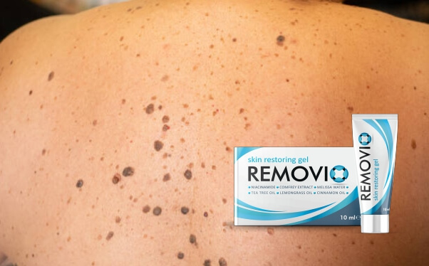 removio gel, skin papillomas