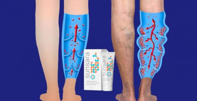 Sunsara Review – All-Natural Gel for the Active Elimination of Varicose Veins