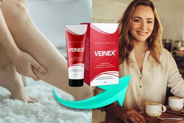 What Is Veinex 