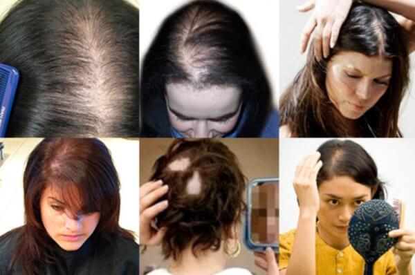 Calendula – for Advanced Hair Care