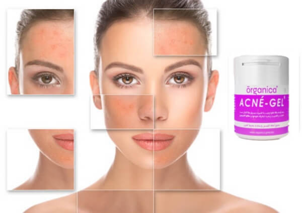 Acne-Gel Review | Treat Acne and Restore Skin Health | Price