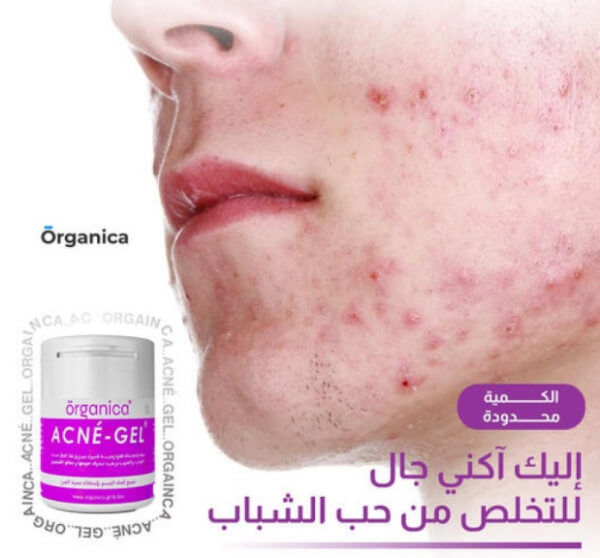 Acne-Gel Price in Algeria 