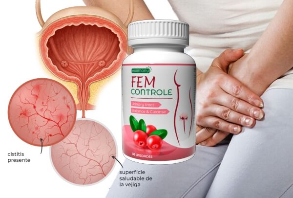 FEM Controle - Price in Colombia and Chile