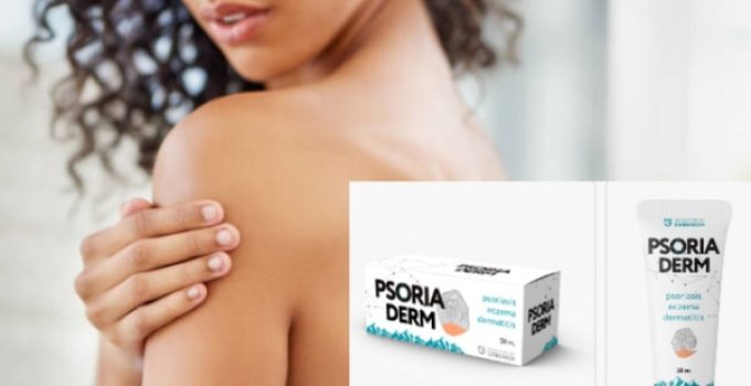 PsoriaDerm Review – All-Natural Cream for the Treatment of Psoriasis, Dermatitis, & Eczema