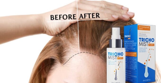 Trichomist Spray – Opinions | Cover Up Bald Patches & Revive Hair