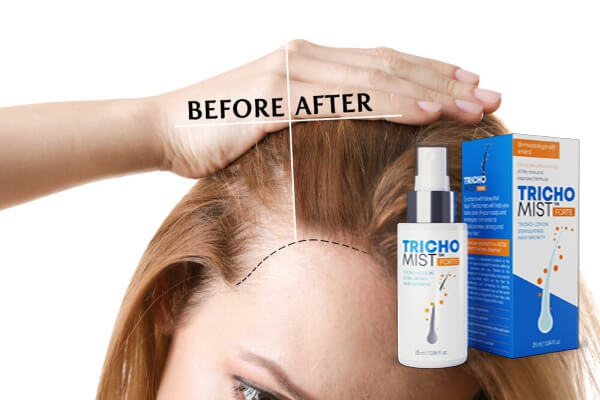 Trichomist Forte Spray Review - Price, opinions, effects