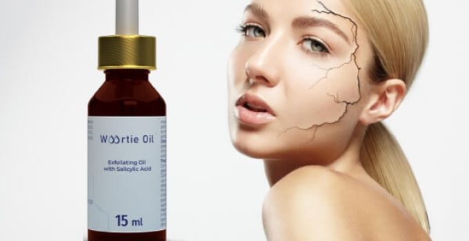 Woortie Oil Opinions – Serum That Removes Warts & Papilloma?