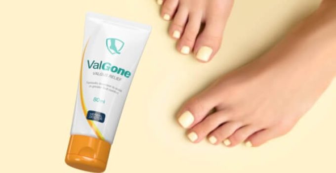 Valgone Reviews – Fight the symptoms of hallux valgus?