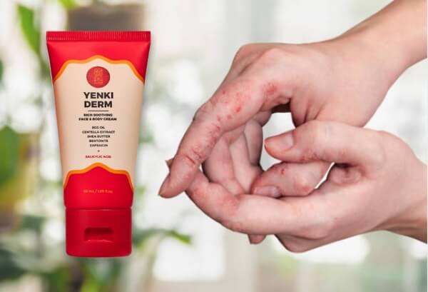 Yenki Derm cream Reviews - Opinions, price, effects