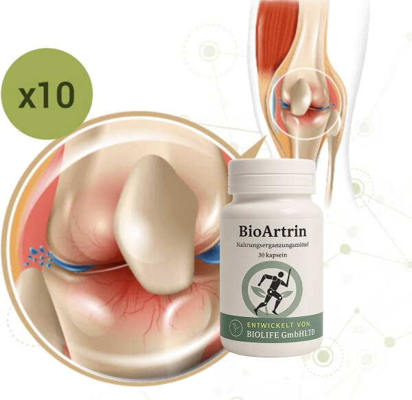 Bioartrin capsules Reviews Germany Austria - Opinions, price, effects